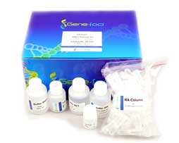 EASYspin細(xì)菌RNA快速提取試劑盒 EASYspin細(xì)菌RNA快速提取試劑盒